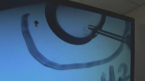 Fertility coverage bill slows down at MN Capitol