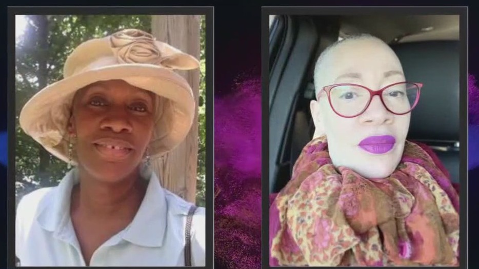 Vitiligo documentary features New Prague woman