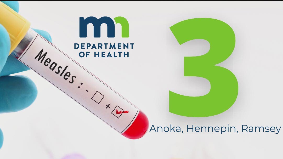 3 new measles cases reported in MN
