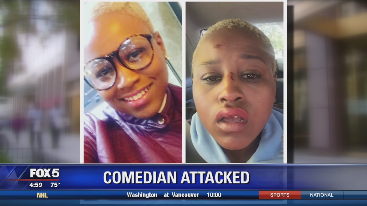 Comedian brutally attacked in DC | FOX 5 DC