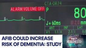 Study on link between afib and dementia