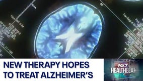 New therapy hopes to treat Alzheimer's disease