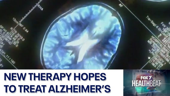 New therapy hopes to treat Alzheimer's disease