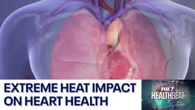 Extreme heat impact on heart health