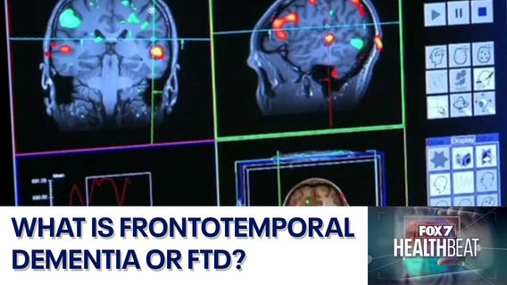 What is frontotemporal dementia?