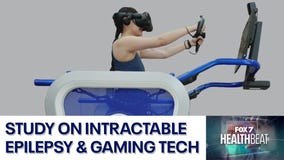 Intractable epilepsy and gaming tech