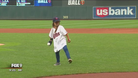 Girl with robotic hand throws pitch at Target Field