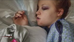 Sledding accident injures Minnesota woman