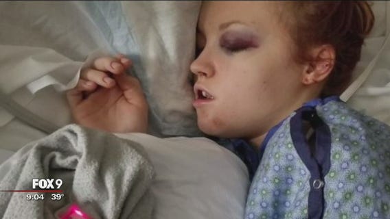 Sledding accident injures Minnesota woman