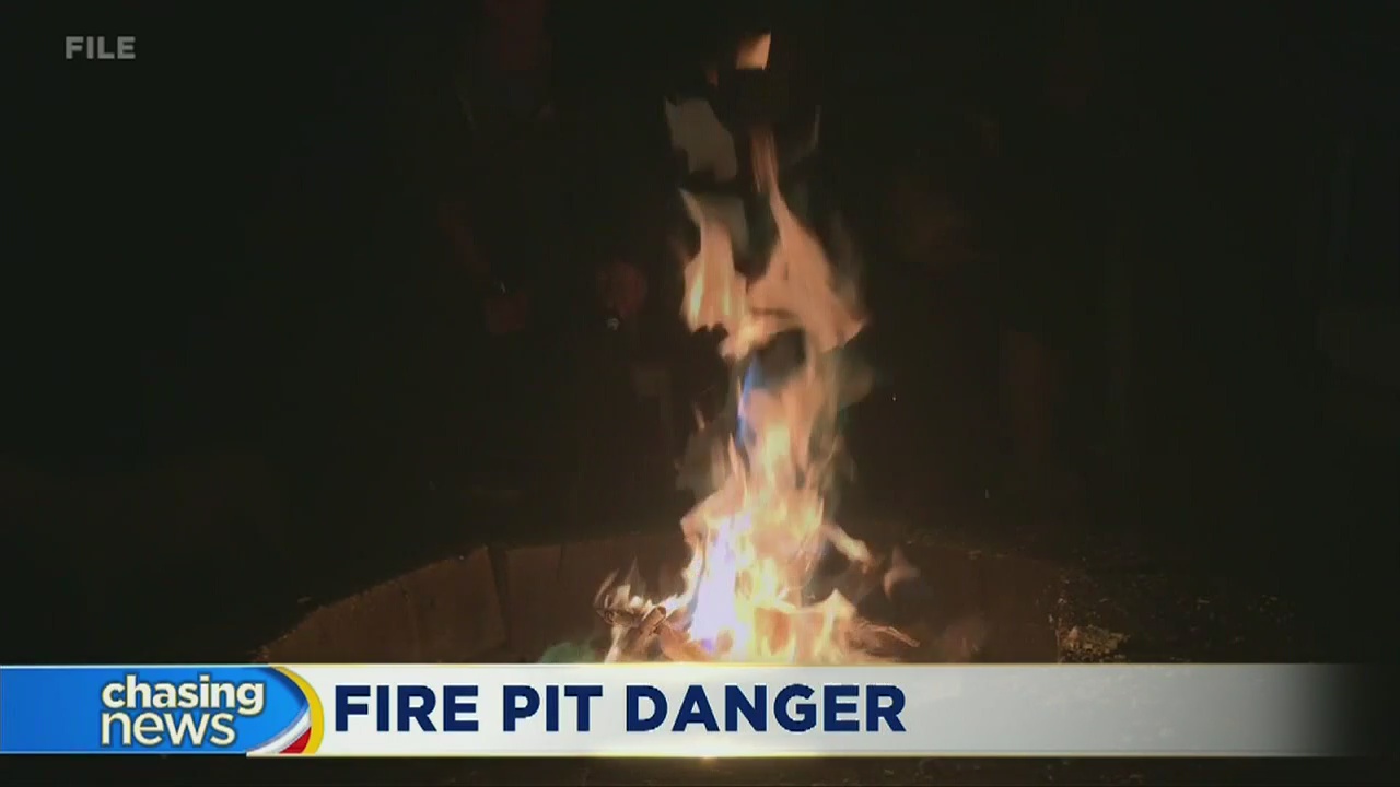 5-year-old girl severely burned in fire pit accident