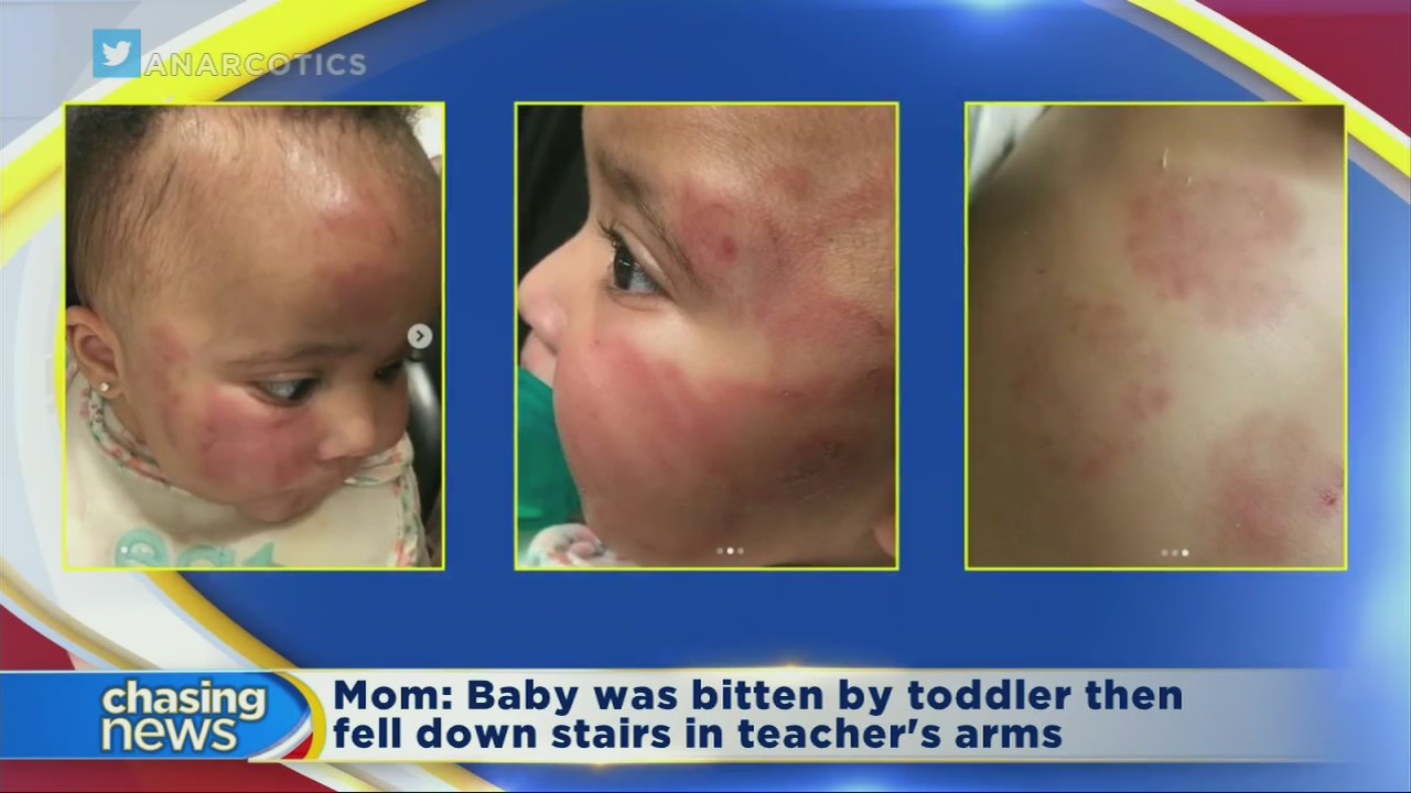 Mom says baby was injured at Newark day care