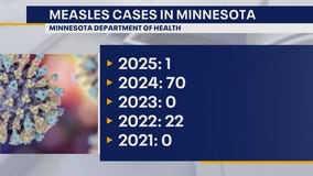 MDH identifies 1st measles case of 2025