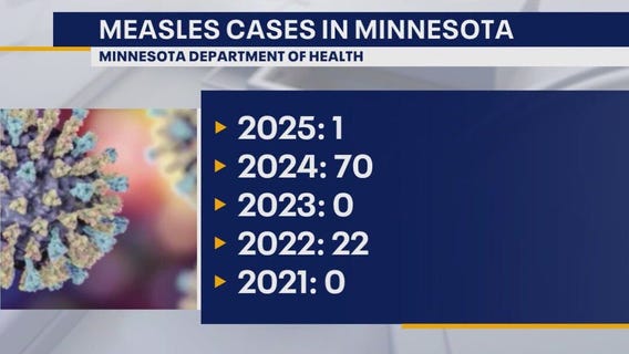 MDH identifies 1st measles case of 2025