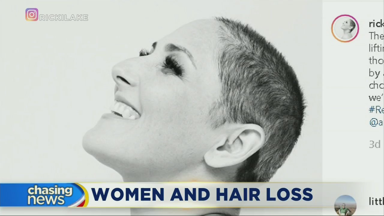 Ricki Lake reveals her struggle with hair loss