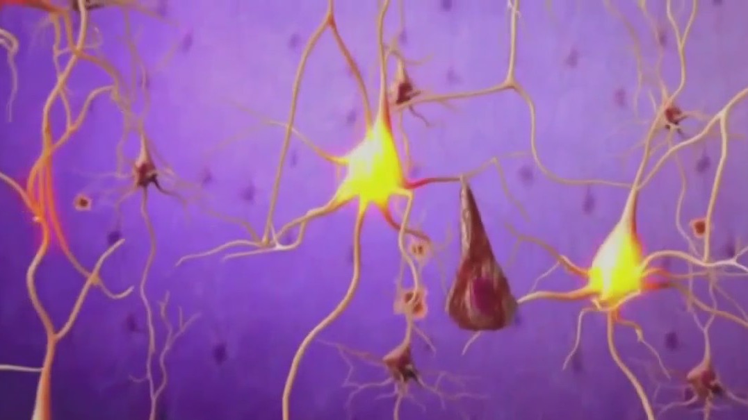 FDA approves new drug for Alzheimer's Disease