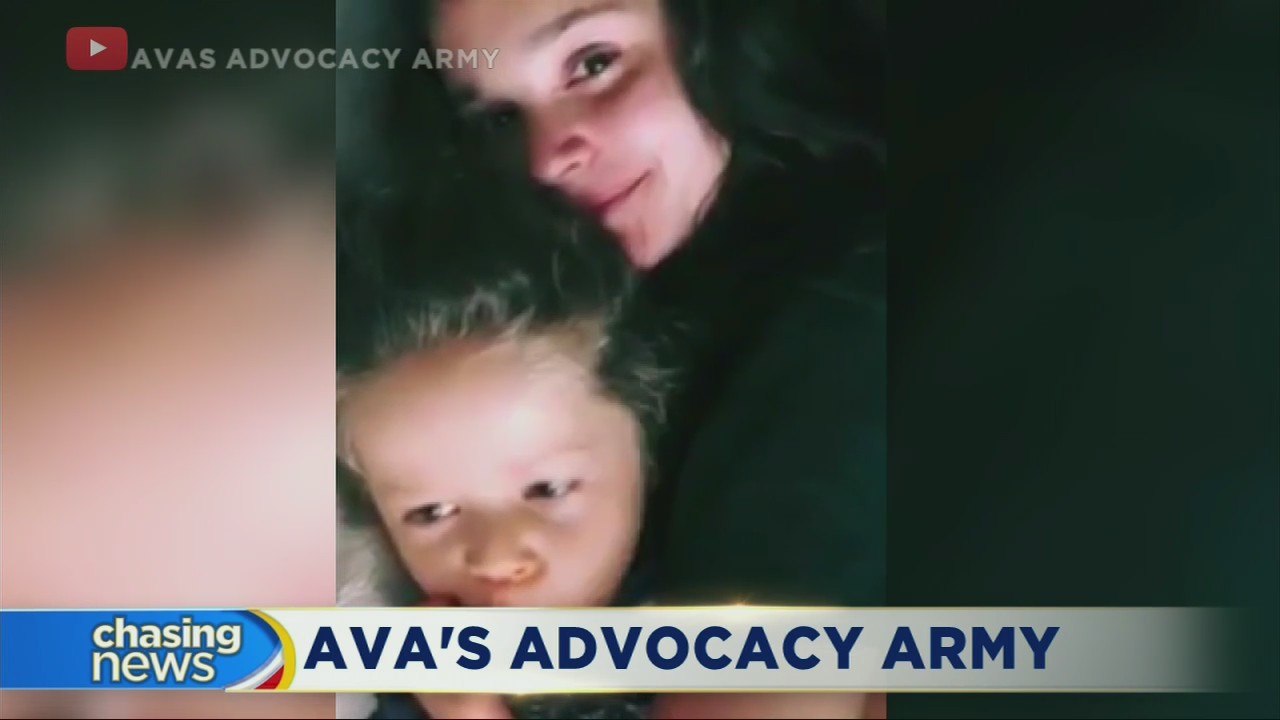 Teen model working to raise awareness for special needs kids