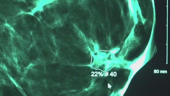 Olivia Munn's breast cancer diagnosis