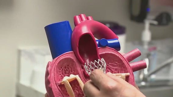 A-fib dangers for younger people