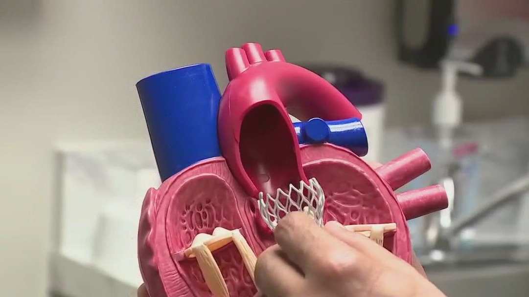 A-fib dangers for younger people