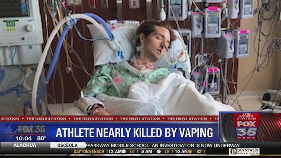 College cheerleader says vaping almost killed him