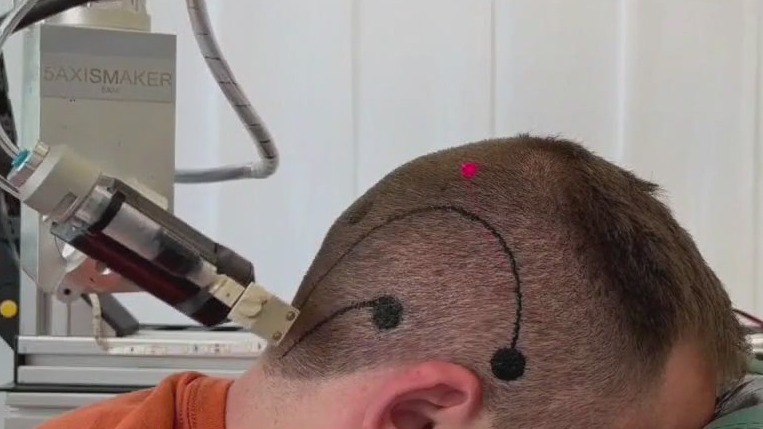 UT researchers look to improve e-tattoos | FOX 7 Focus