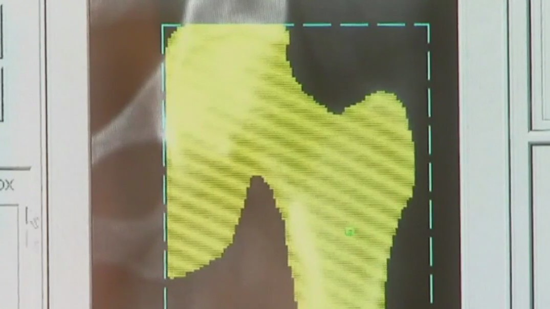 Seniors and cold weather injuries