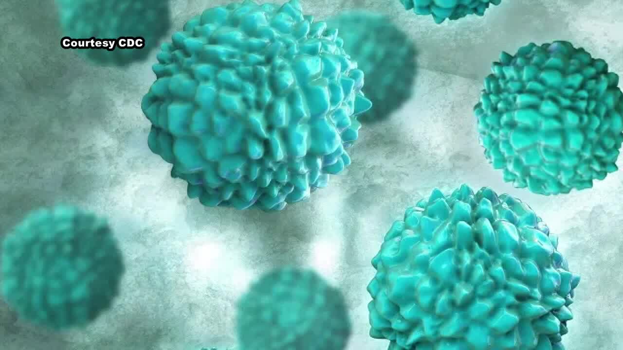 Norovirus on the rise in Austin, doctor says
