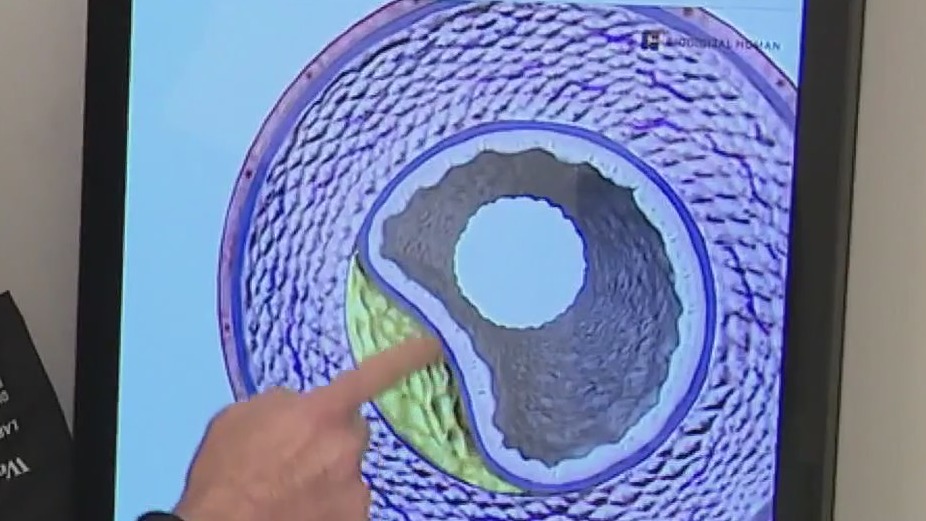 Calcium tests: Why they're important