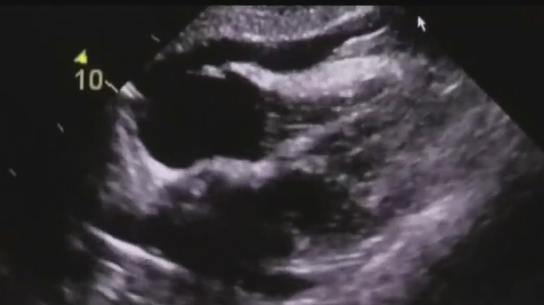 American Heart Month: Cardiovascular health