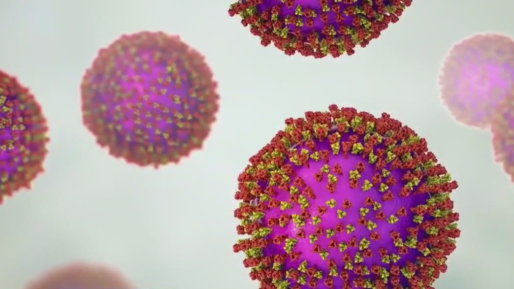 Measles outbreak across Texas