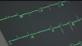 Daylight saving effects on the heart