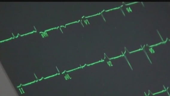 Daylight saving effects on the heart