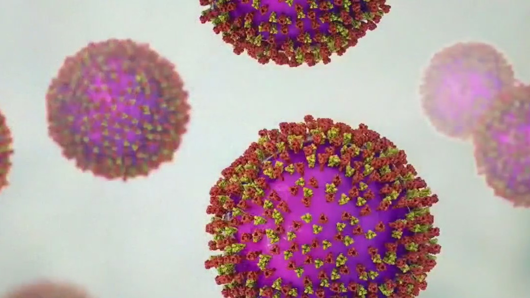 Measles outbreak could get worse