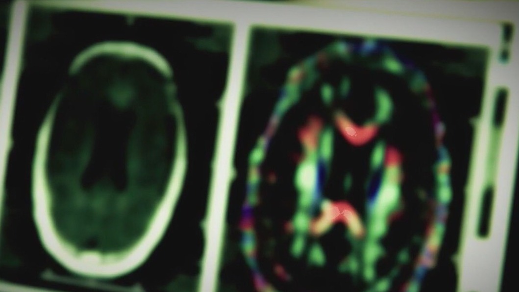 NeuroDiversion 2025: Celebrating neurodiversity