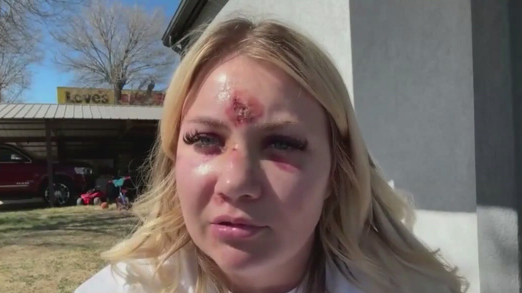 Bride-to-be attacked in Dallas