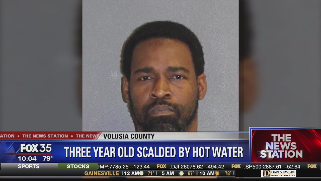 Child injured from scalding water