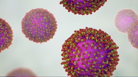 Second measles case reported in Travis County