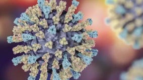Measles case in Travis County