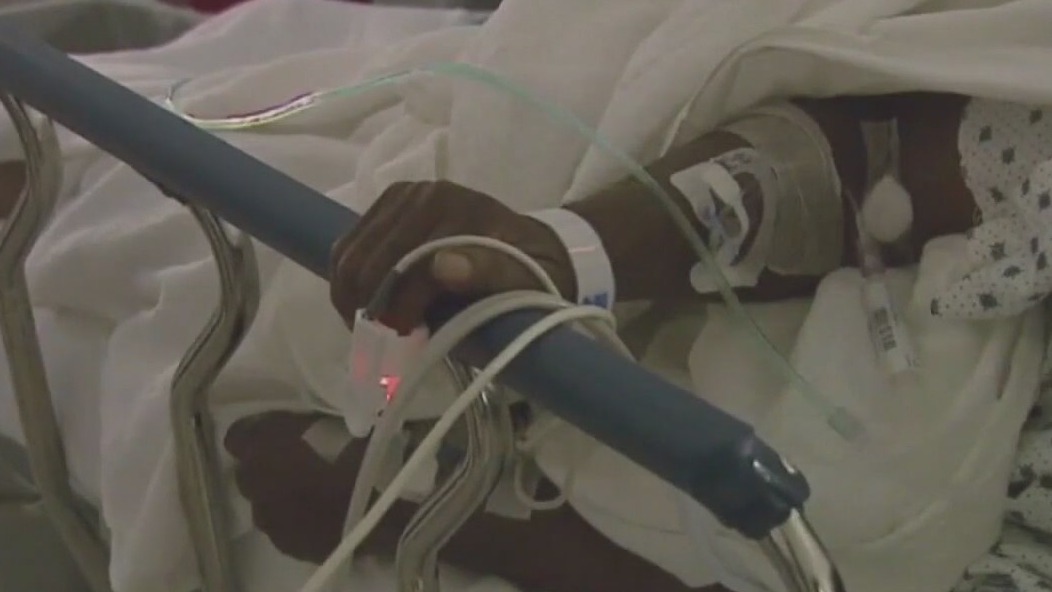 Colon cancer in younger adults