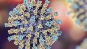 Leander child tests positive for measles