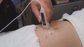 Trump administration changes abortion policy