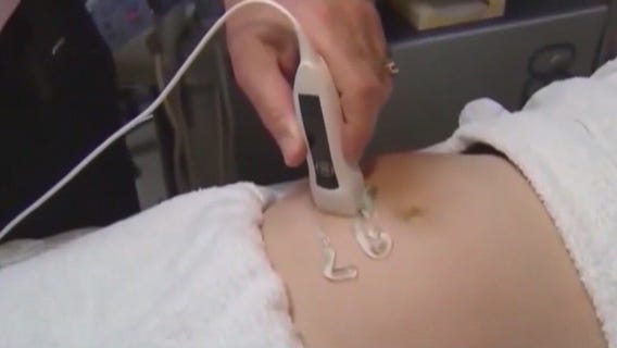 Trump administration changes abortion policy