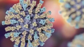 Measles traced in Austin-Travis County wastewater