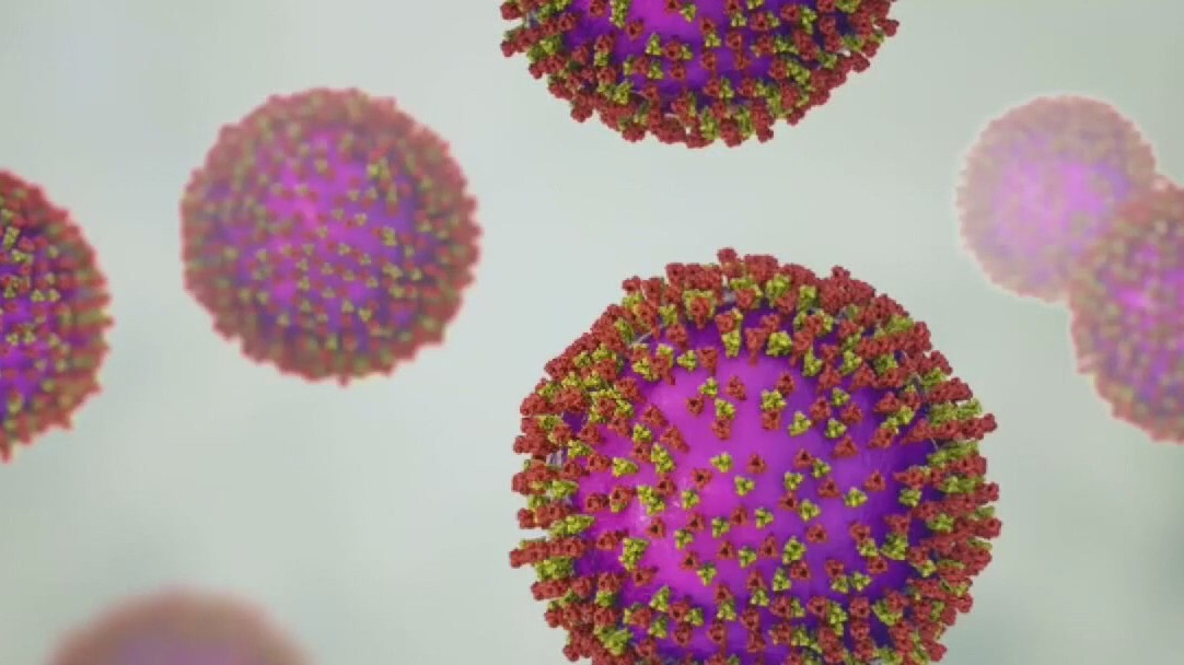 Measle outbreak in Texas declared over