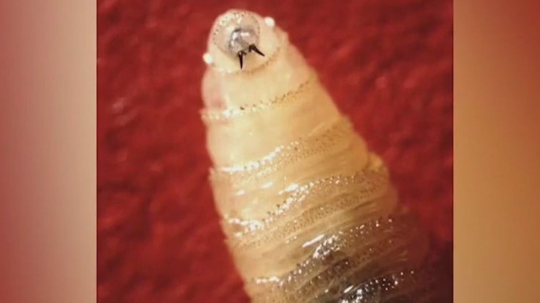 Screwworm: 1st human case in United States