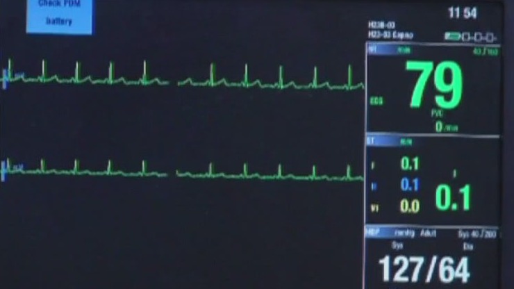 New study looks at heart attacks in younger women