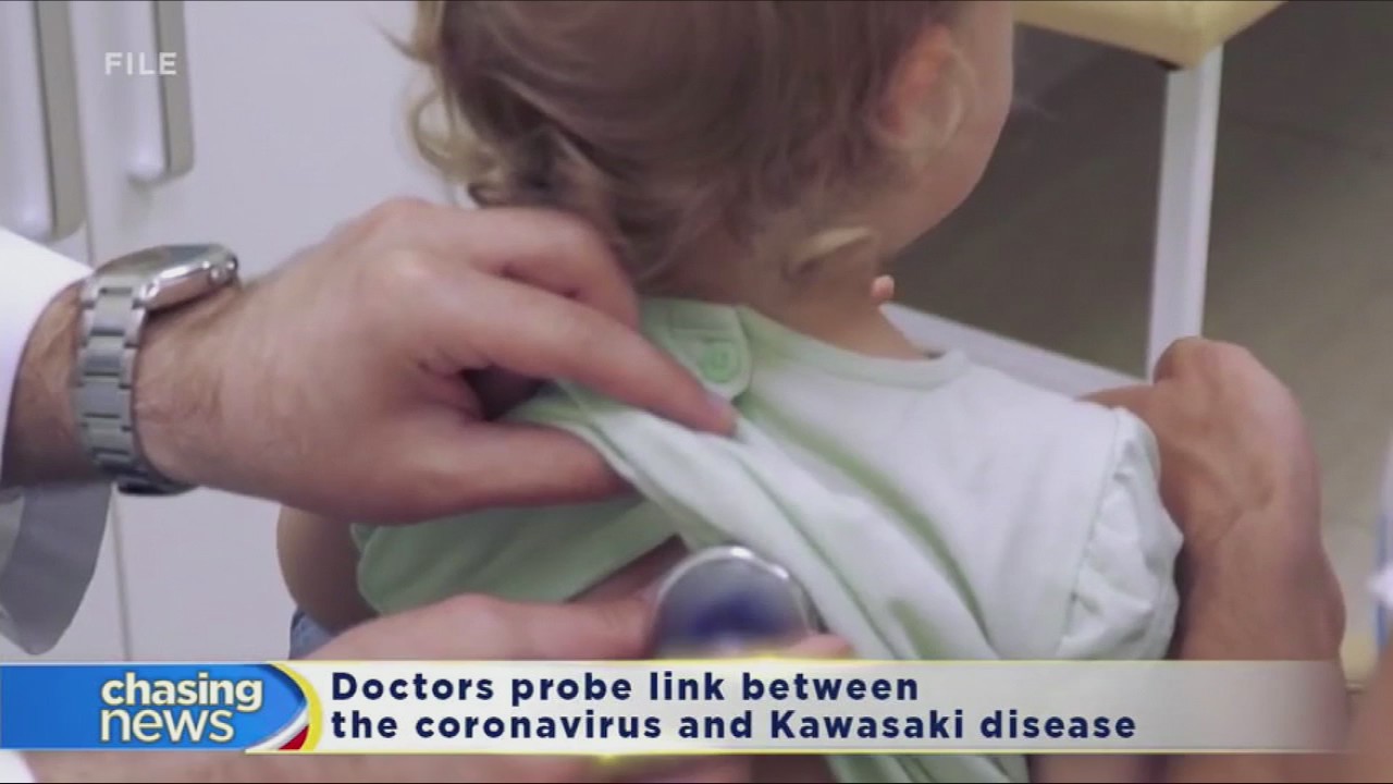 Doctors probe link between the coronavirus and Kawasaki disease