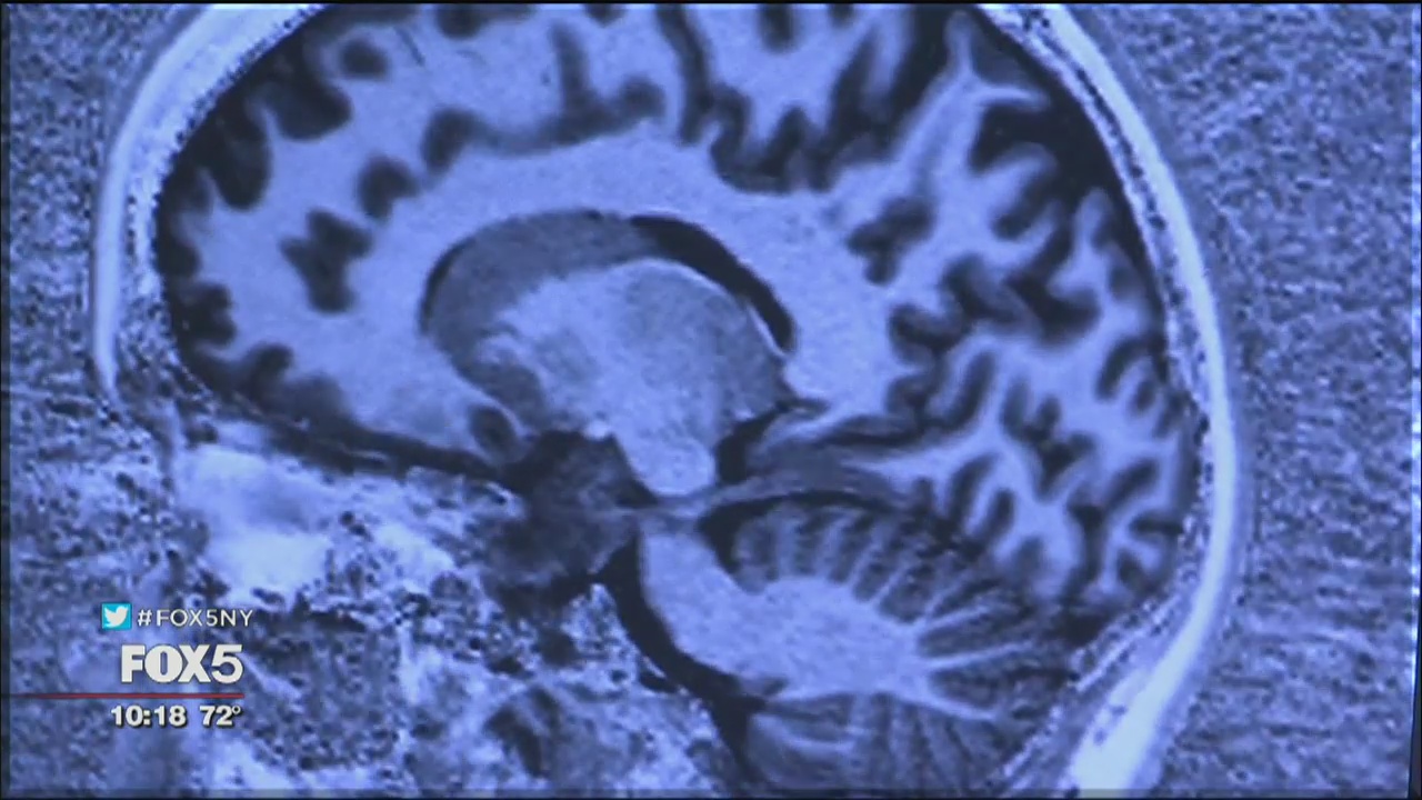 The Big Idea: Prayer triggers brain rewards