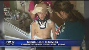 Miraculous recovery: Teen defies the odds