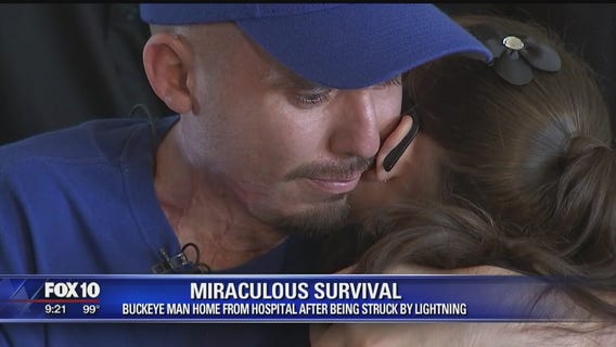 Buckeye man home from hospital after surviving being struck by lightning